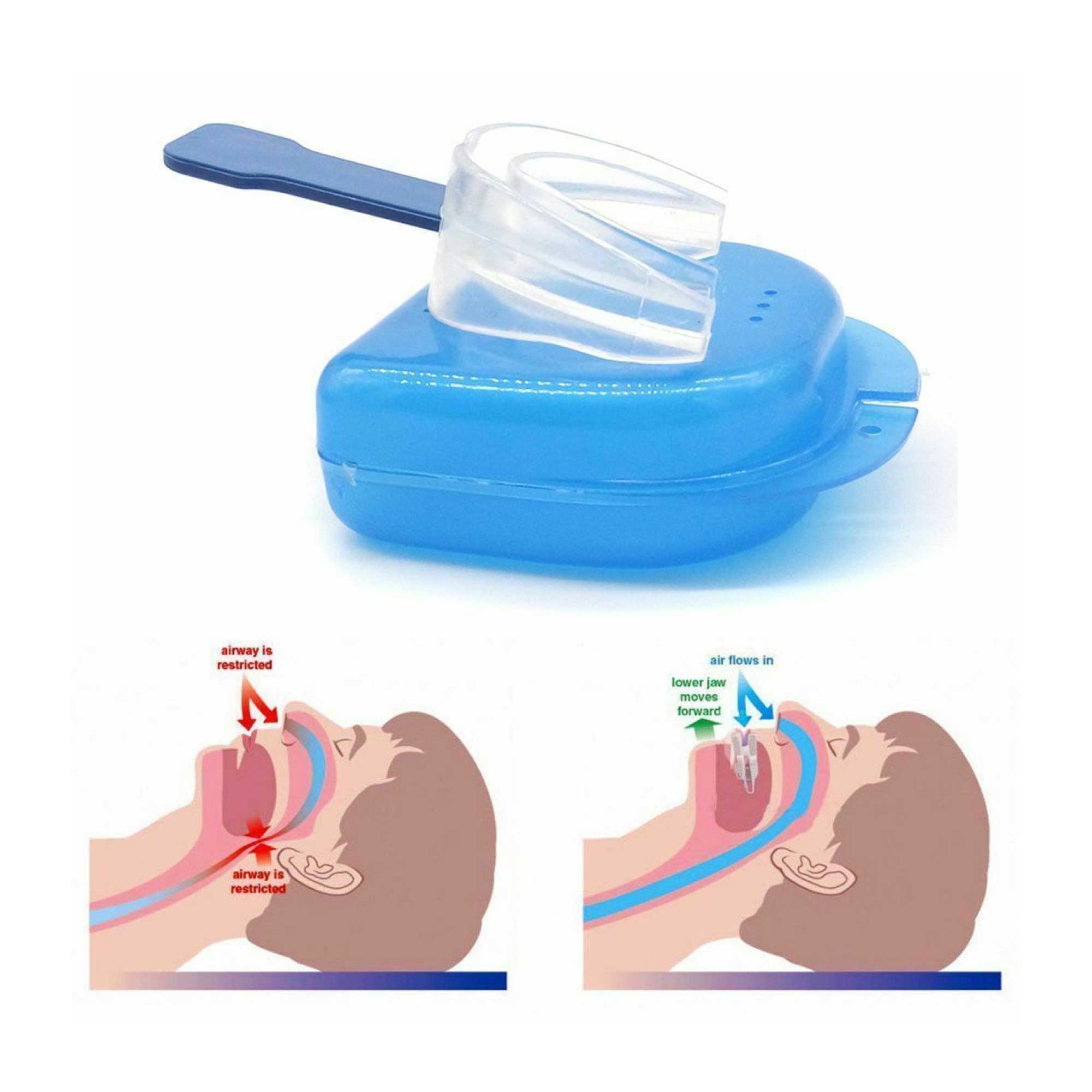 Sleeping Aids: Mouthguard Mouthpiece + Nose Clip Anti Snoring Aid Sleep Breathing Device