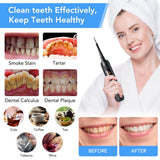 Automotive Decor: Electric Ultrasonic Dental Tartar Plaque Calculus Tooth Remover Set Kits Cleaner with LED Screen