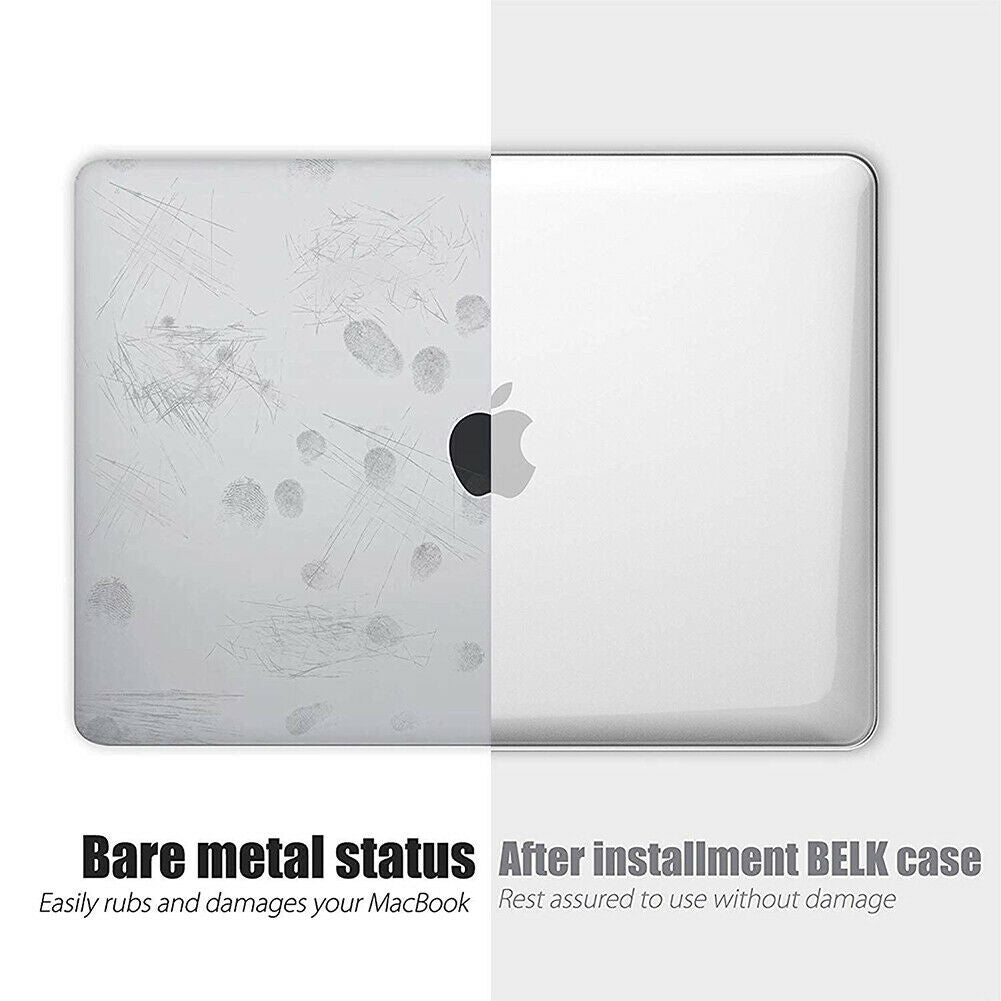 Cases & Skins: 2020 Macbook Pro 13 Inch Case Plastic Hard Case Shell for 2020 Macbook Pro A2251 A2289 A2179(Clear)