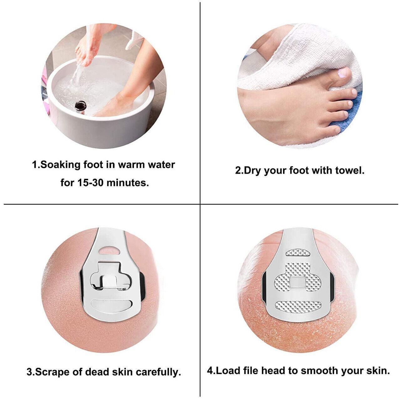 Foot Care: Foot File Hard Skin Remover Callus Shaver Corn Cutter Tool Pedicure + 10 Blades