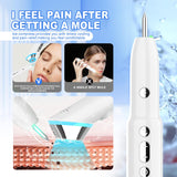 Advanced 3-in-1 Skin Care Device: 15-Level Spot Remover Pen with Hot & Cold Facial Therapy(White)