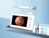All-in-One Wireless Visual Ear Cleaner Kit with 4.3" IPS Display Screen(white)