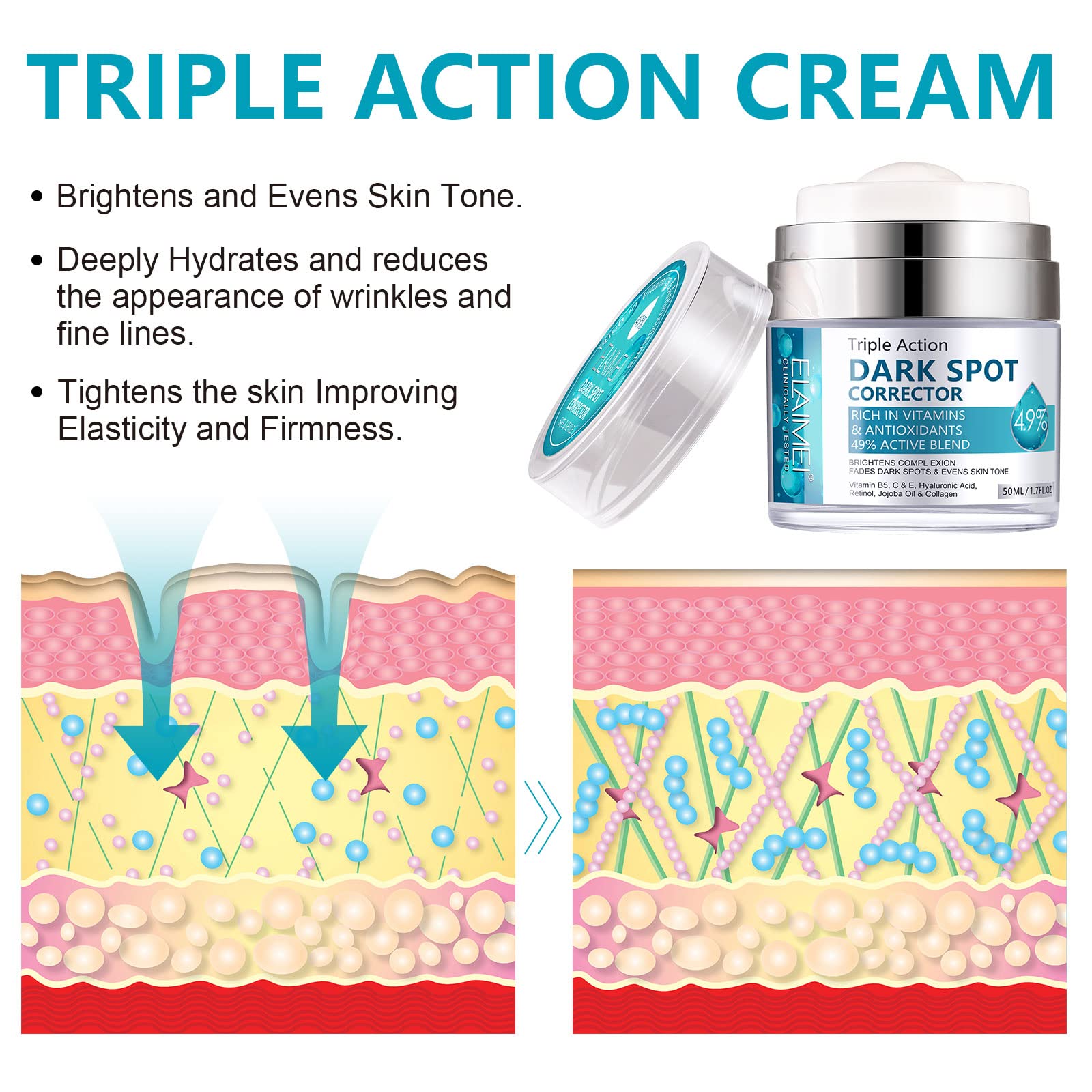 Facial Lotions & Moisturisers: Age Spot Cream | Fades Freckles & Skin Pigmentation | Dark Spot Corrector for Even Skin Tone