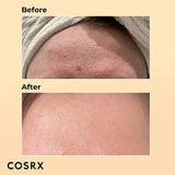 COSRX Advanced Snail 96 Mucin Power Essence - 100ml